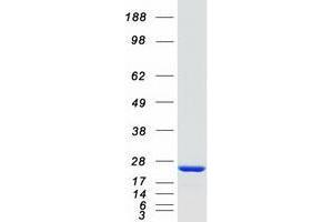 Validation with Western Blot