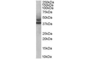 Image no. 1 for anti-Tripartite Motif Containing 54 (TRIM54) (C-Term) antibody (ABIN374312) (TRIM54 Antikörper  (C-Term))