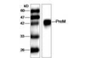 Image no. 1 for anti-West Nile Virus (WNV) (AA 1-135) antibody (ABIN791626) (West Nile Virus Antikörper  (AA 1-135))