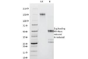 SDS-PAGE Analysis Purified CD44 Mouse Monoclonal Antibody (DF1485). (CD44 Antikörper)