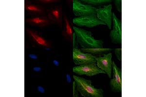 ABIN6259270 and ABIN6274431 staining  cells by IF/ICC. (PPHLN1 Antikörper  (N-Term))