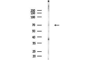 Western blot analysis of lysates from F10-LUC cells(UV,30 min treatment), using Phospho- (Thr69/Thr51) Antibody at 1/1000 dilution.