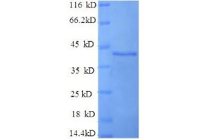SDS-PAGE (SDS) image for Selenoprotein P (SEPP1) (AA 20-381) protein (His tag) (ABIN5710334)