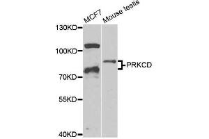 Western blot analysis of extracts of various cell lines, using PRKCD antibody. (PKC delta Antikörper  (AA 477-676))