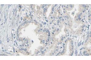 ABIN6276843 at 1/100 staining Human prostate tissue by IHC-P. (Annexin V Antikörper  (C-Term))
