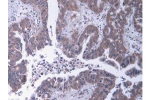 Immunohistochemistry (IHC) image for anti-Heparan Sulfate Proteoglycan 2 (HSPG2) (AA 4149-4391) antibody (ABIN7435115)