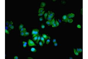 Immunofluorescent analysis of MCF-7 cells using ABIN7159082 at dilution of 1:100 and Alexa Fluor 488-congugated AffiniPure Goat Anti-Rabbit IgG(H+L) (MLX Antikörper  (AA 1-244))
