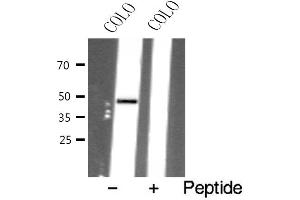 Western blot analysis of extracts from COLO cells using AVPR1B antibody. (AVPR1B Antikörper  (Internal Region))