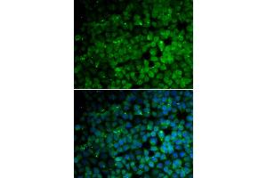 Immunofluorescence analysis of HeLa cells using TRIM13 antibody (ABIN6293541). (TRIM13 Antikörper)