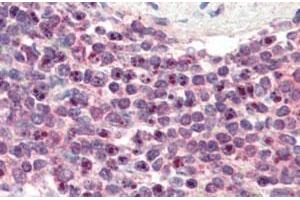 NR1H2 polyclonal antibody  (3 ug/mL) staining of paraffin embedded human spleen.