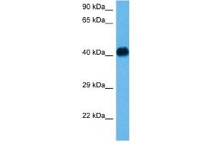 Host:  Mouse  Target Name:  NFKBIB  Sample Tissue:  Mouse Heart  Antibody Dilution:  1ug/ml (NFKBIB Antikörper  (N-Term))