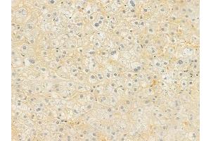 ABIN6262011 and ABIN6277630 at 1/100 staining human normal liver tissue by IHC-P. (GNAS Antikörper  (C-Term))