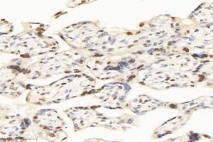 Immunohistochemistry analysis of paraffin-embedded human placenta using,SET (ABIN7075583) at dilution of 1: 10000 (SET/TAF-I Antikörper)
