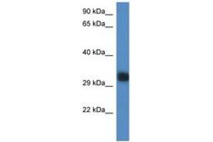 Image no. 1 for anti-Predicted Gene 527 (GM527) (AA 218-267) antibody (ABIN6746331) (GM527 Antikörper  (AA 218-267))