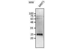 Anti-Rab38 Ab at 1/2,500 dilution, Iysates at 50 µg per Iane, rabbit polyclonal to goat (HRP) at 1/10,000 dilution, (RAB38 Antikörper  (C-Term))