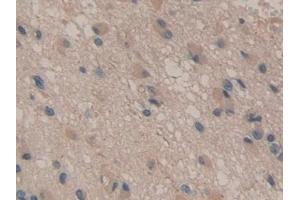 Immunohistochemistry (IHC) image for anti-ATPase, Na+/K+ Transporting, beta 3 Polypeptide (ATP1B3) (AA 61-273) antibody (ABIN7440134)