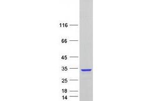 Western Blotting (WB) image for Thymocyte Nuclear Protein 1 (THYN1) (Transcript Variant 5) protein (Myc-DYKDDDDK Tag) (ABIN2733663)