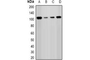 Western blot analysis of PHC1 expression in Hela (A), Jurkat (B), A549 (C), mouse kidney (D) whole cell lysates. (PHC1 Antikörper)