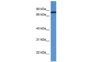 WB Suggested Anti-HHIPL1 Antibody Titration: 0. (HHIPL1 Antikörper  (C-Term))