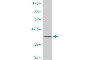 Western Blot detection against Immunogen (37. (MAP3K14 Antikörper  (AA 847-947))