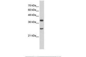 Image no. 1 for anti-Cytosolic Iron-Sulfur Protein Assembly 1 (CIAO1) (AA 247-296) antibody (ABIN203313) (CIAO1 Antikörper  (AA 247-296))