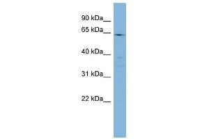 CYP4F3 antibody used at 1 ug/ml to detect target protein. (CYP4F3 Antikörper  (N-Term))