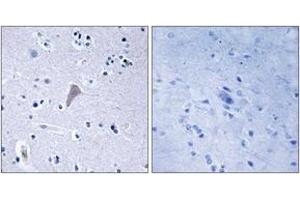 Immunohistochemistry analysis of paraffin-embedded human brain tissue, using mTOR (Ab-2448) Antibody. (MTOR Antikörper  (AA 2415-2464))