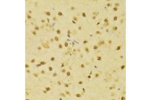 Immunohistochemistry of paraffin-embedded Rat brain using NeuN antibody at dilution of 1:100 (x400 lens).
