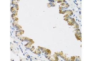 Immunohistochemistry (Paraffin-embedded Sections) (IHC (p)) image for anti-Cyclin-Dependent Kinase Inhibitor 2C (p18, Inhibits CDK4) (CDKN2C) antibody (ABIN7260089)