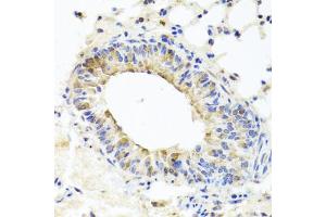 Immunohistochemistry of paraffin-embedded mouse lung using MUC16 antibody (ABIN6003713) at dilution of 1/100 (40x lens). (MUC16 Antikörper)