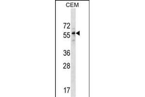 DPH2 Antibody (N-term) (ABIN1538986 and ABIN2849764) western blot analysis in CEM cell line lysates (35 μg/lane). (DPH2 Antikörper  (N-Term))