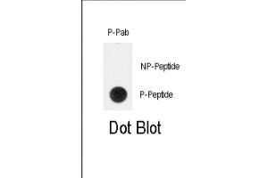 Dot Blot (DB) image for anti-Telomerase Reverse Transcriptase (TERT) (pTyr707) antibody (ABIN3001892) (TERT Antikörper  (pTyr707))