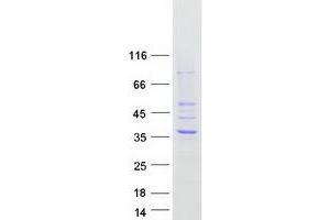 Validation with Western Blot (HSD17B13 Protein (Transcript Variant A) (Myc-DYKDDDDK Tag))