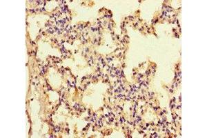 Immunohistochemistry of paraffin-embedded human lung tissue using ABIN7156789 at dilution of 1:100 (IL-13 Antikörper  (AA 30-125))