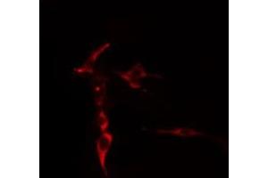 ABIN6276893 staining  COLO205 cells by IF/ICC. (Syndecan 2 Antikörper  (C-Term))
