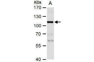 WB Image NBS1 antibody detects NBS1 protein by western blot analysis. (Nibrin Antikörper)