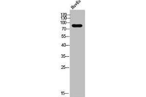 Western Blot analysis of HuvEC cells using DGK-β Polyclonal Antibody (DGKB Antikörper  (C-Term))