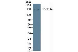 Figure. (Phospholipase C beta 3, Phosphoinositide Specific (AA 318-468) Antikörper)