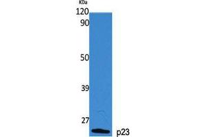 Western Blot (WB) analysis of specific cells using p23 Polyclonal Antibody. (CDK5R1 Antikörper  (Tyr579))