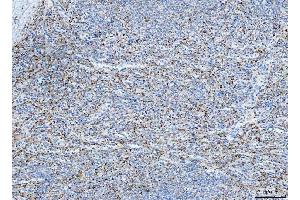 IHC analysis of FHL2 using anti-FHL2 antibody (ABIN7600782). (FHL2 Antikörper  (AA 234-279))