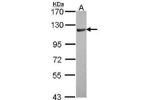 WB Image Sample (30 ug of whole cell lysate) A: JurKat 7. (ARHGAP4 Antikörper  (N-Term))
