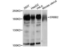 Western blot analysis of extracts of various cell lines, using ErbB2 antibody. (ErbB2/Her2 Antikörper  (C-Term))