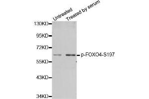 Western blot analysis of extracts from 293 cells using phospho-FOXO4-S197 antibody (ABIN2987524). (FOXO4 Antikörper  (pSer197))