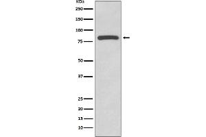 Western blot analysis of Glycogen synthase expression in HeLa cell lysate.