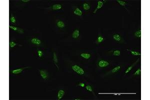 Immunofluorescence of purified MaxPab antibody to DUSP4 on HeLa cell. (DUSP4 Antikörper  (AA 1-394))