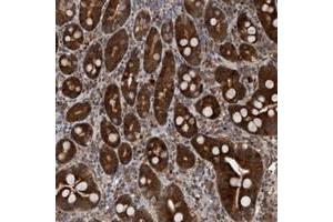 Immunohistochemical staining of human duodenum with TANC2 polyclonal antibody  strong cytoplasmic positivity in glandular cells. (TANC2 Antikörper)