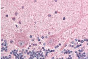 Human Brain, Cerebellum (formalin-fixed, paraffin-embedded) stained with ING4 antibody ABIN292976 at 2. (ING4 Antikörper  (AA 164-175))