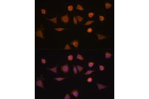 Immunofluorescence analysis of L929 cells using GST Rabbit pAb (8266) at dilution of 1:100 (40x lens). (GSTA1 Antikörper  (AA 1-222))