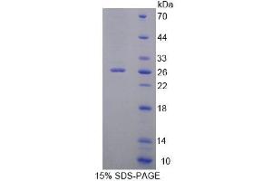SDS-PAGE (SDS) image for DnaJ (Hsp40) Homolog, Subfamily C, Member 2 (DNAJC2) (AA 442-621) protein (His tag) (ABIN6238988)
