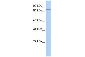 FBXO42 antibody used at 1 ug/ml to detect target protein.